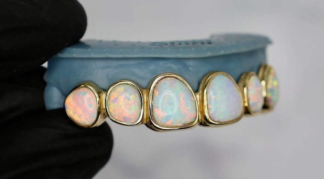 Opal Grillz ( Priced per tooth)