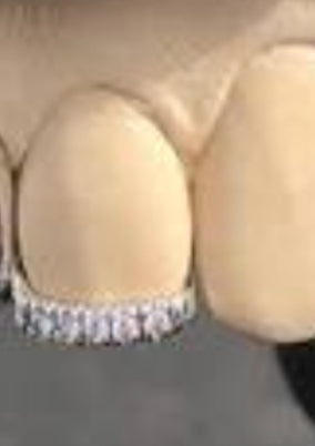 Diamond tip 10k and moissanites