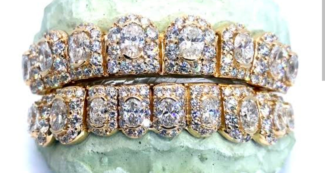 4th year anniversary sale price per tooth. $100 per tooth