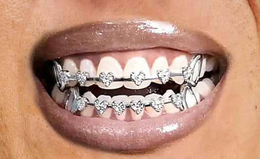 Heart Braces Design ( Priced For 8 Top 8 Bottom)