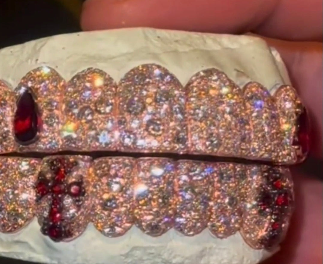 4th year anniversary sale price per tooth. $100 per tooth